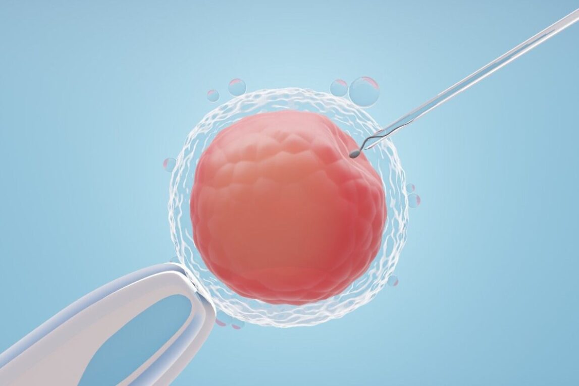 In Vitro Fertilization