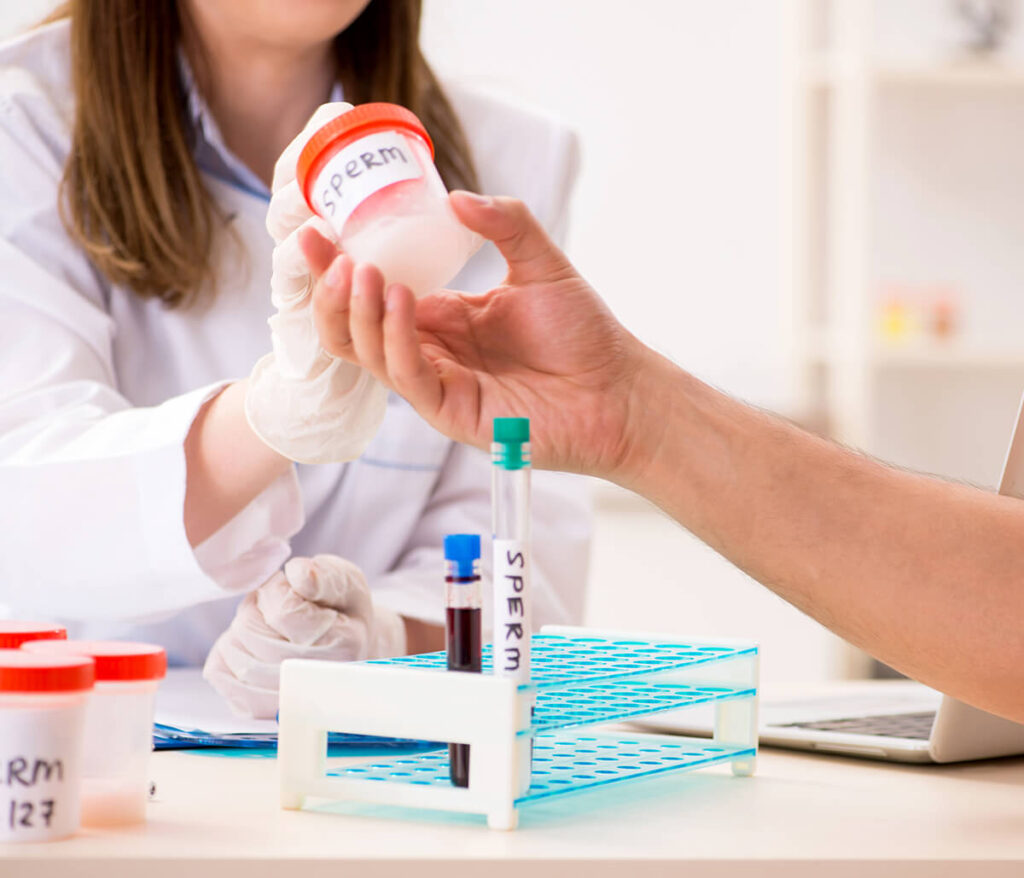 Semen analysis test